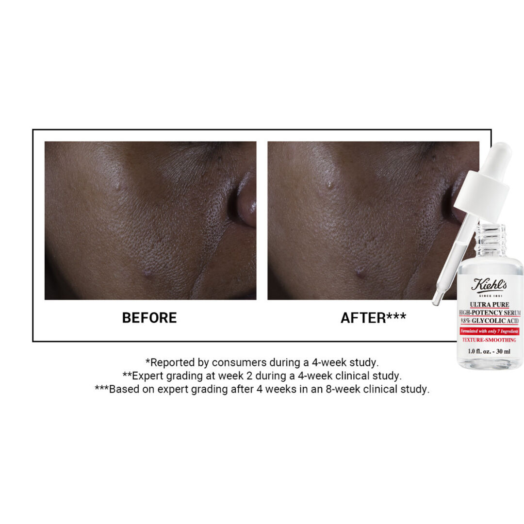 Ultra Pure High-Potency Serum 9.8% Glycolic Acid - KIEHL'S - Pure Serums - Imagem 5