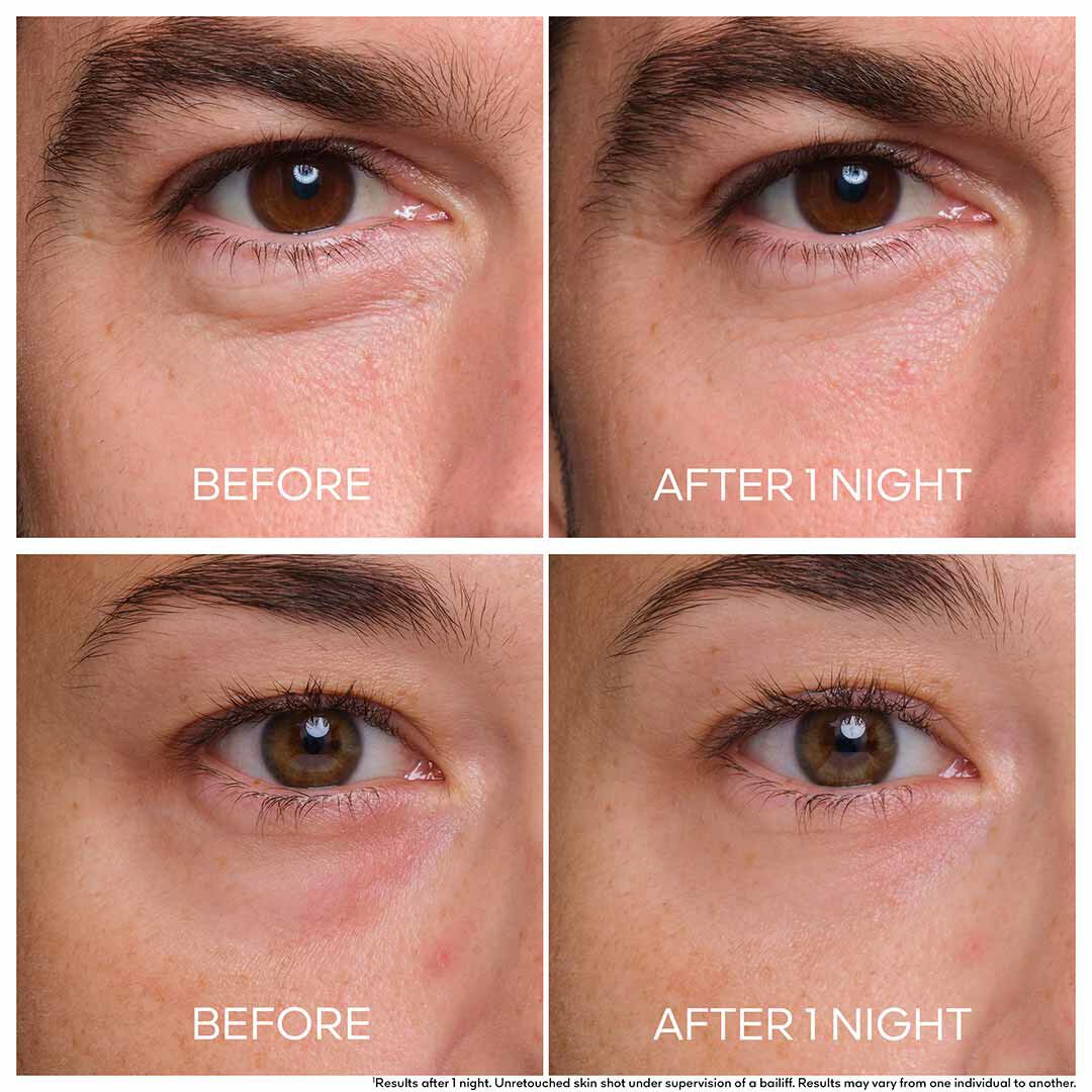 Tratamento Midnight Secret - Contorno de Olhos - GUERLAIN - ABEILLE ROYALE - Imagem 2
