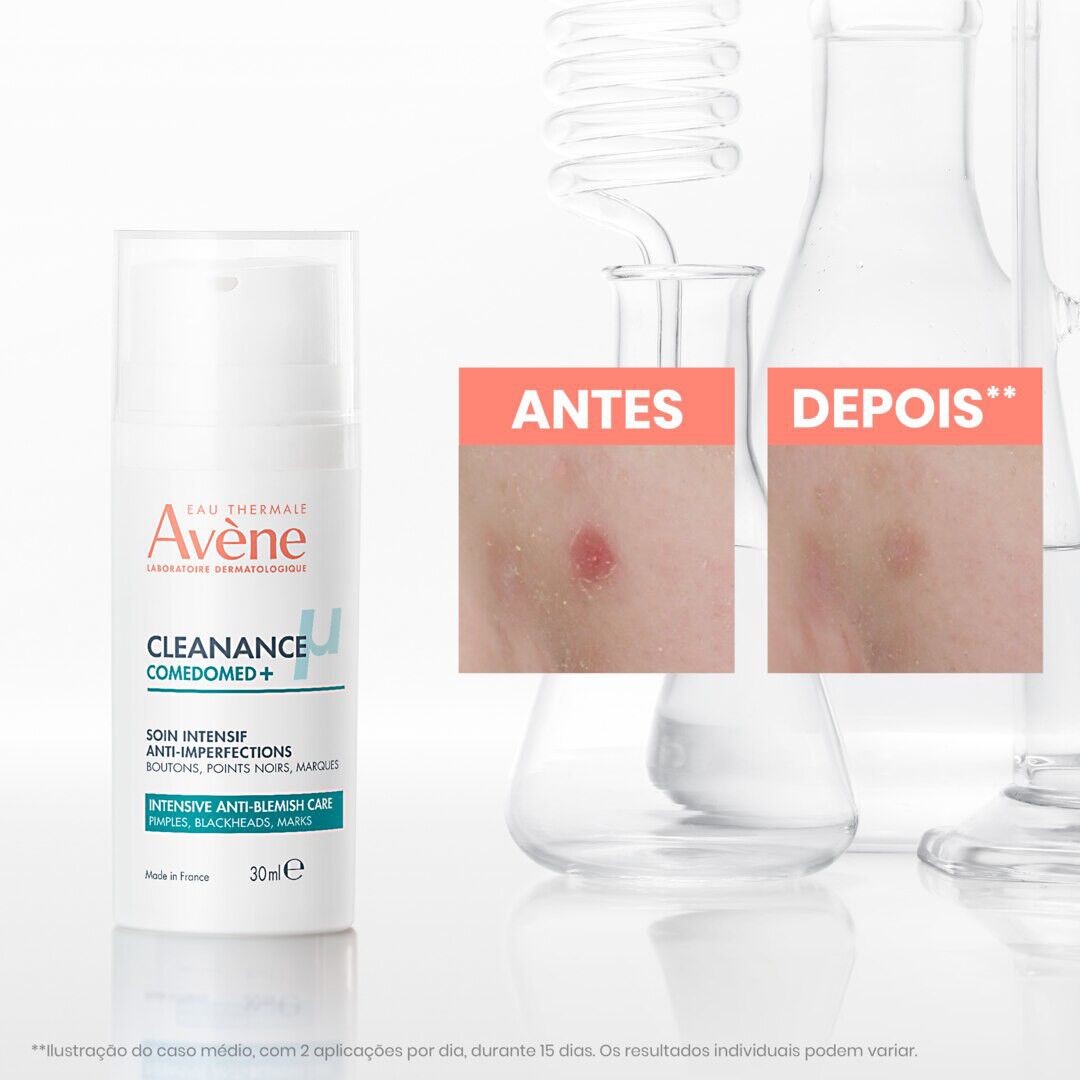 Cleanance Comedomed+ Concentrado Anti-imperfei&ccedil;&otilde;es - AVENE -  - Imagem 6