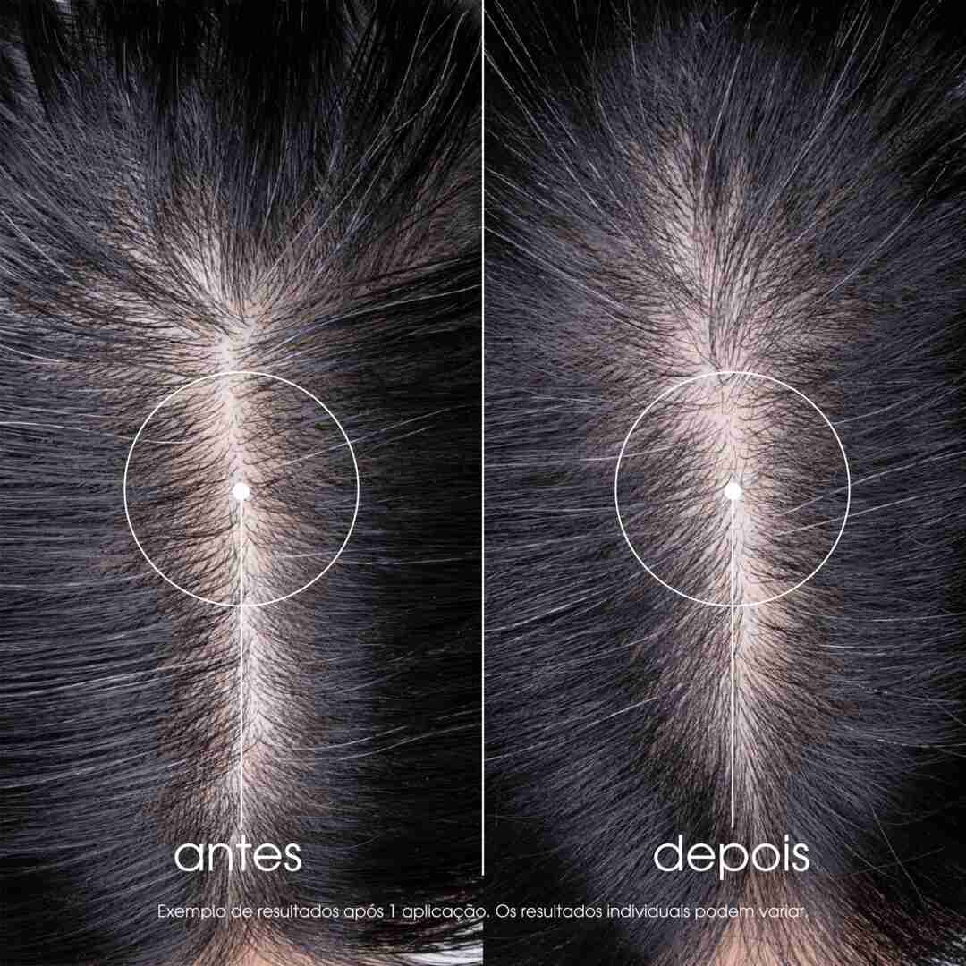 Champô Menta - KLORANE -  - Imagem 5