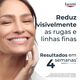Hyaluron-Filler x3 Effect Creme de Dia - Pele Seca FPS 15 - EUCERIN -  - Imagem 2
