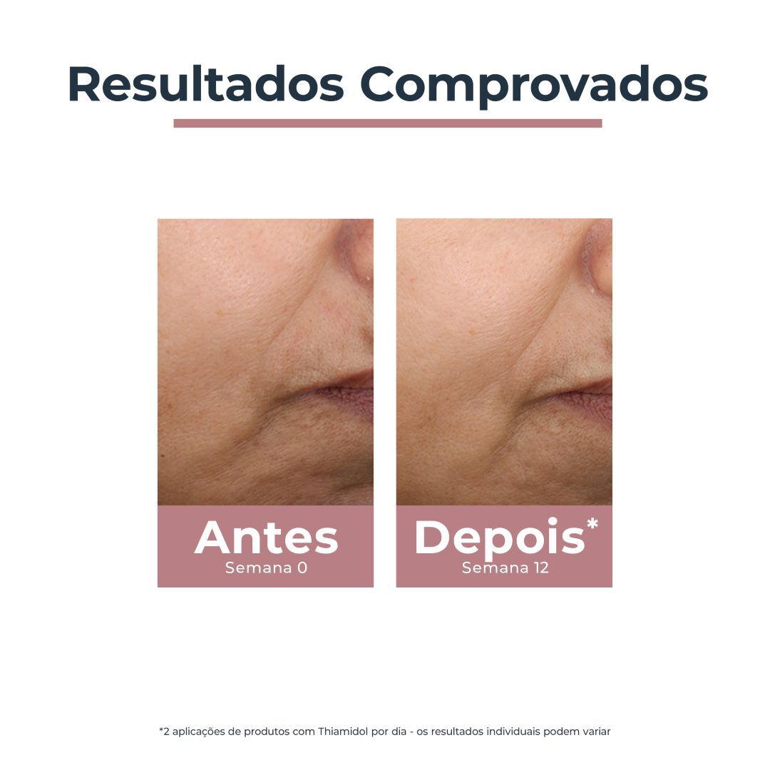 Anti-Pigment Creme de Dia Tinted Médio FPS 30 - EUCERIN -  - Imagem 7