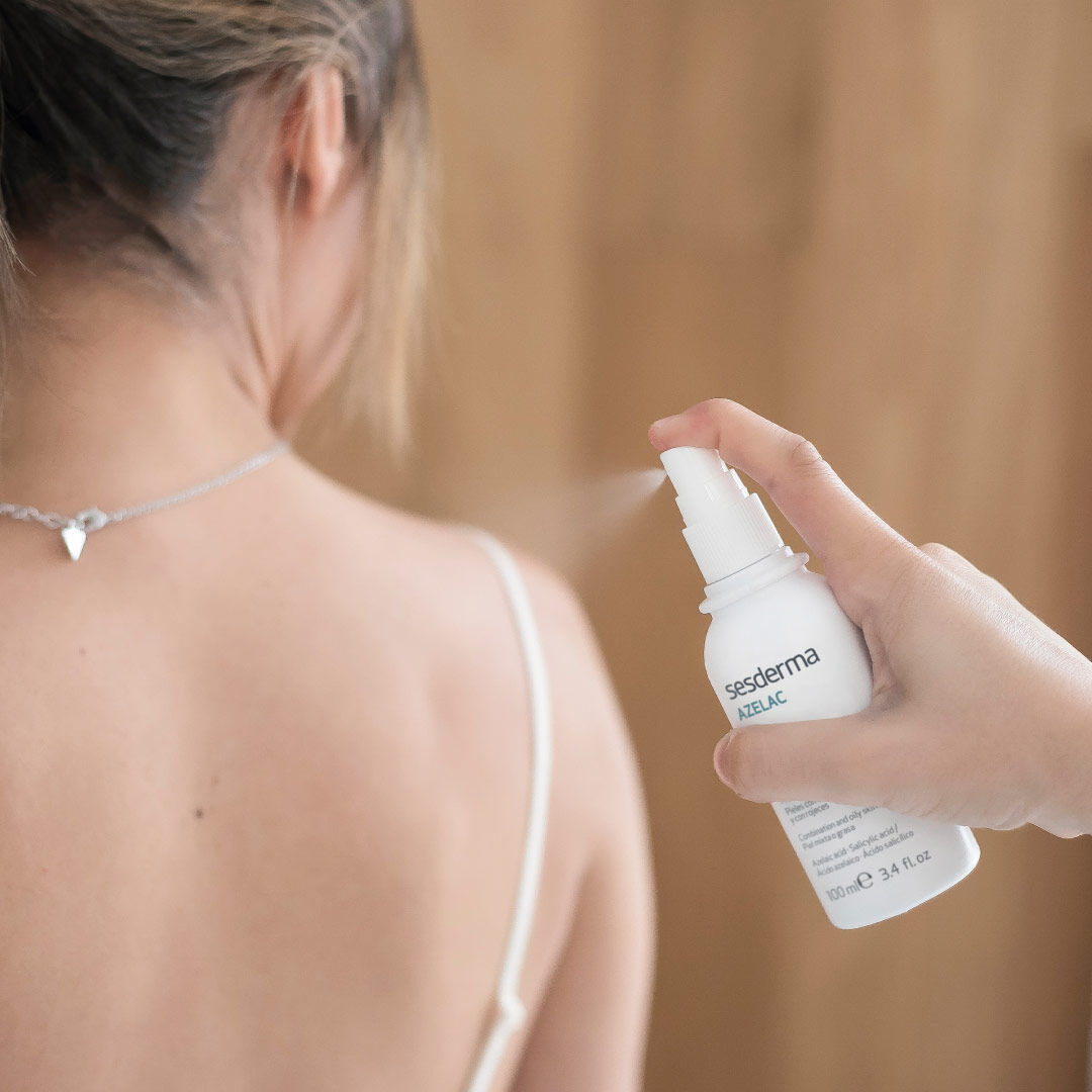 Azelac Lo&ccedil;&atilde;o Corporal - SESDERMA -  - Imagem 2