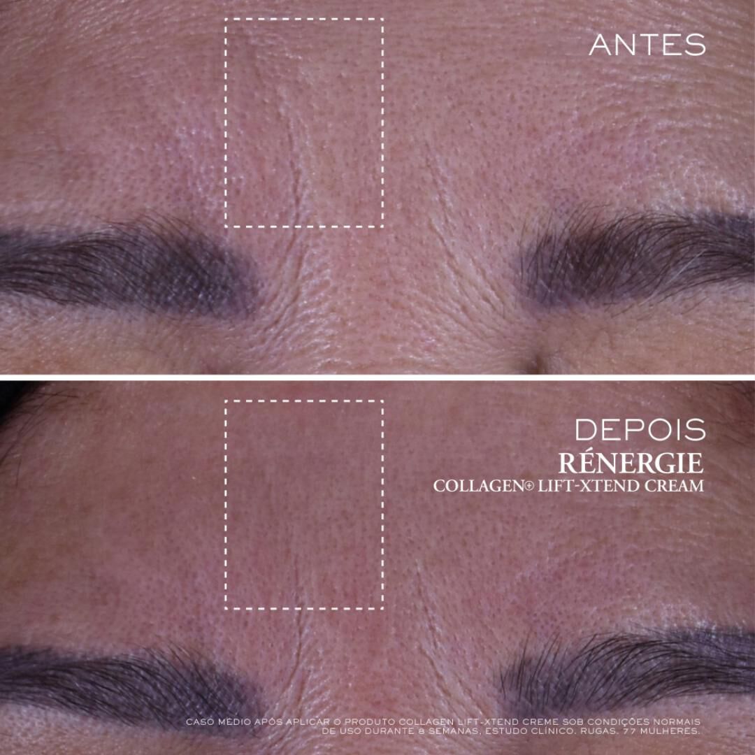 Collagen+ Lift-Xtend Creme - Lanc&ocirc;me - R&eacute;nergie - Imagem 6