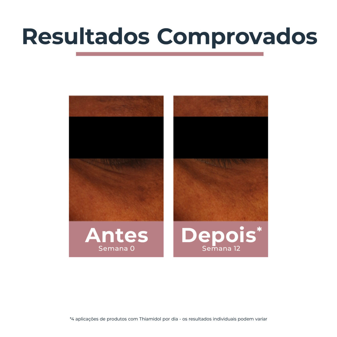 Anti-Pigment Contorno de Olhos Iluminador Antiolheiras - EUCERIN -  - Imagem 5