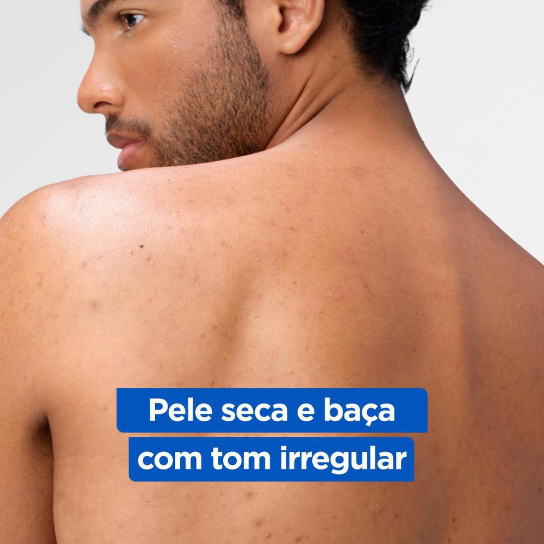 Lo&ccedil;&atilde;o Niacinamida - MIXA -  - Imagem 11