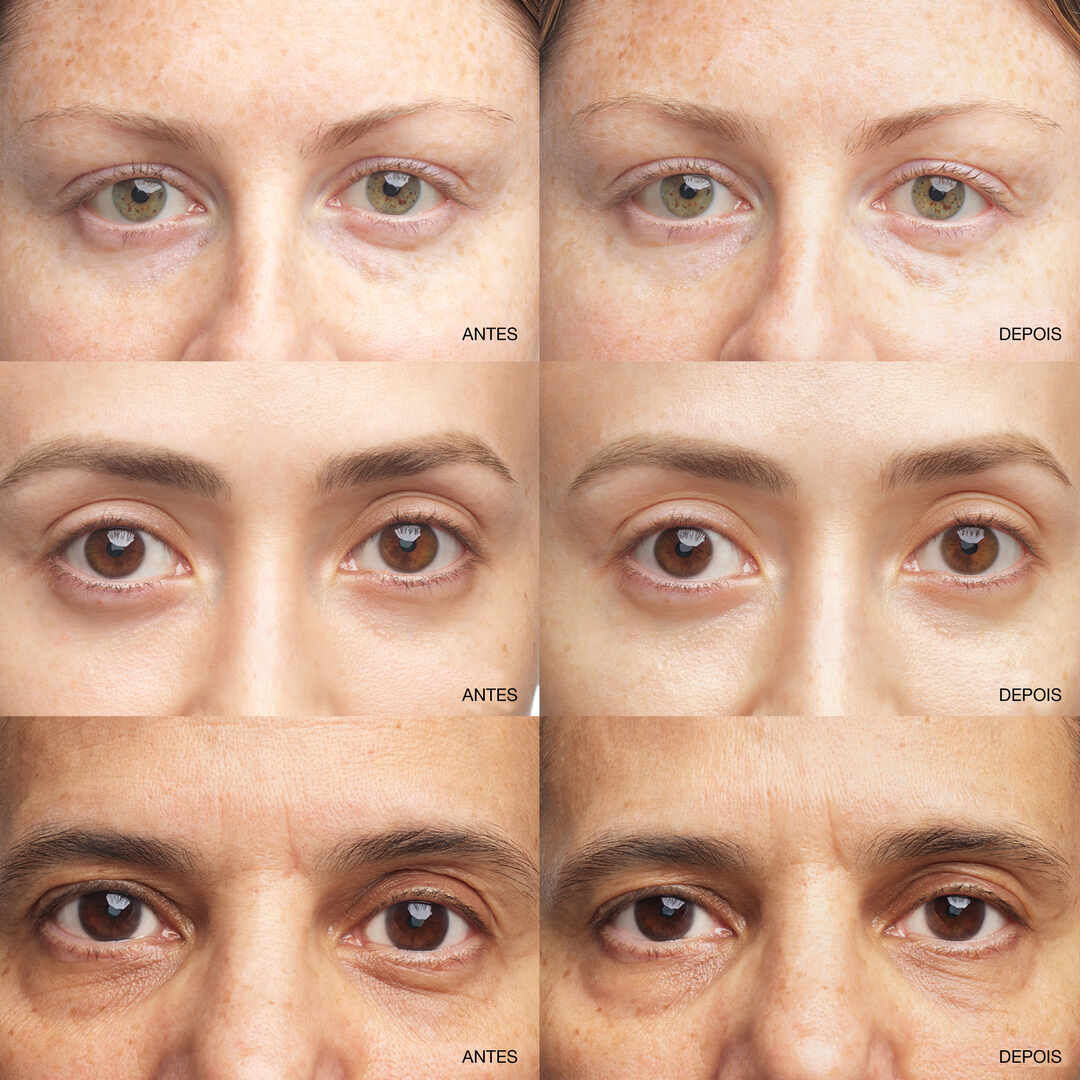 Brightening Serum Concentrate - CLINIQUE - All About Eyes - Imagem 4
