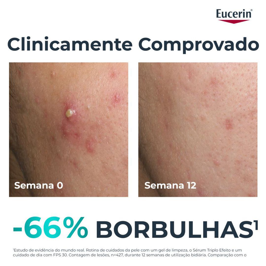 DermoPure Sérum Triplo Efeito - EUCERIN -  - Imagem 7