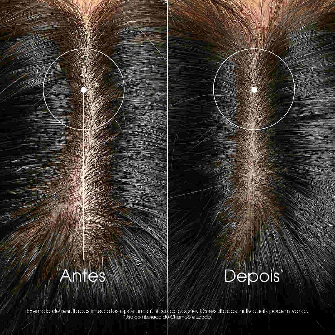 Galanga Champ&ocirc; Anticaspa Reequilibrante - KLORANE -  - Imagem 18