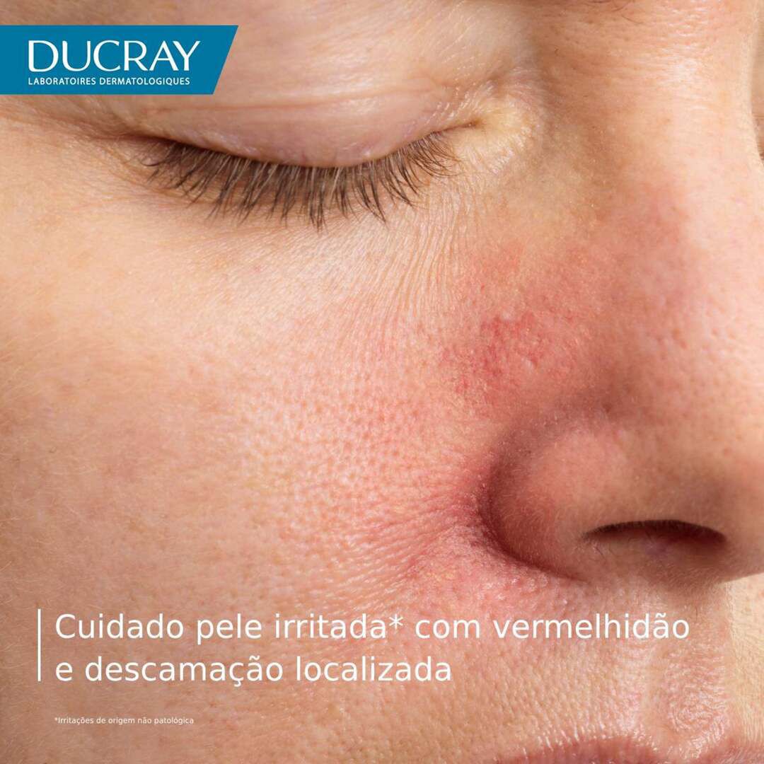 Kelual DS Creme Calmante 40ML - DUCRAY -  - Imagem 5