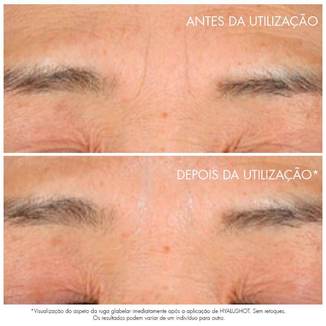 Hyalushot - Dior - Capture Totale - Imagem 11