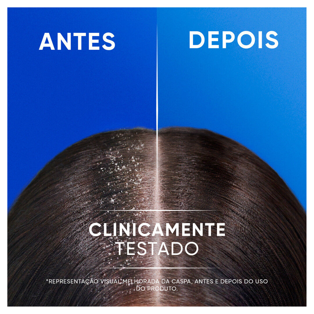 Champ&ocirc; Classic - H&S -  - Imagem 5