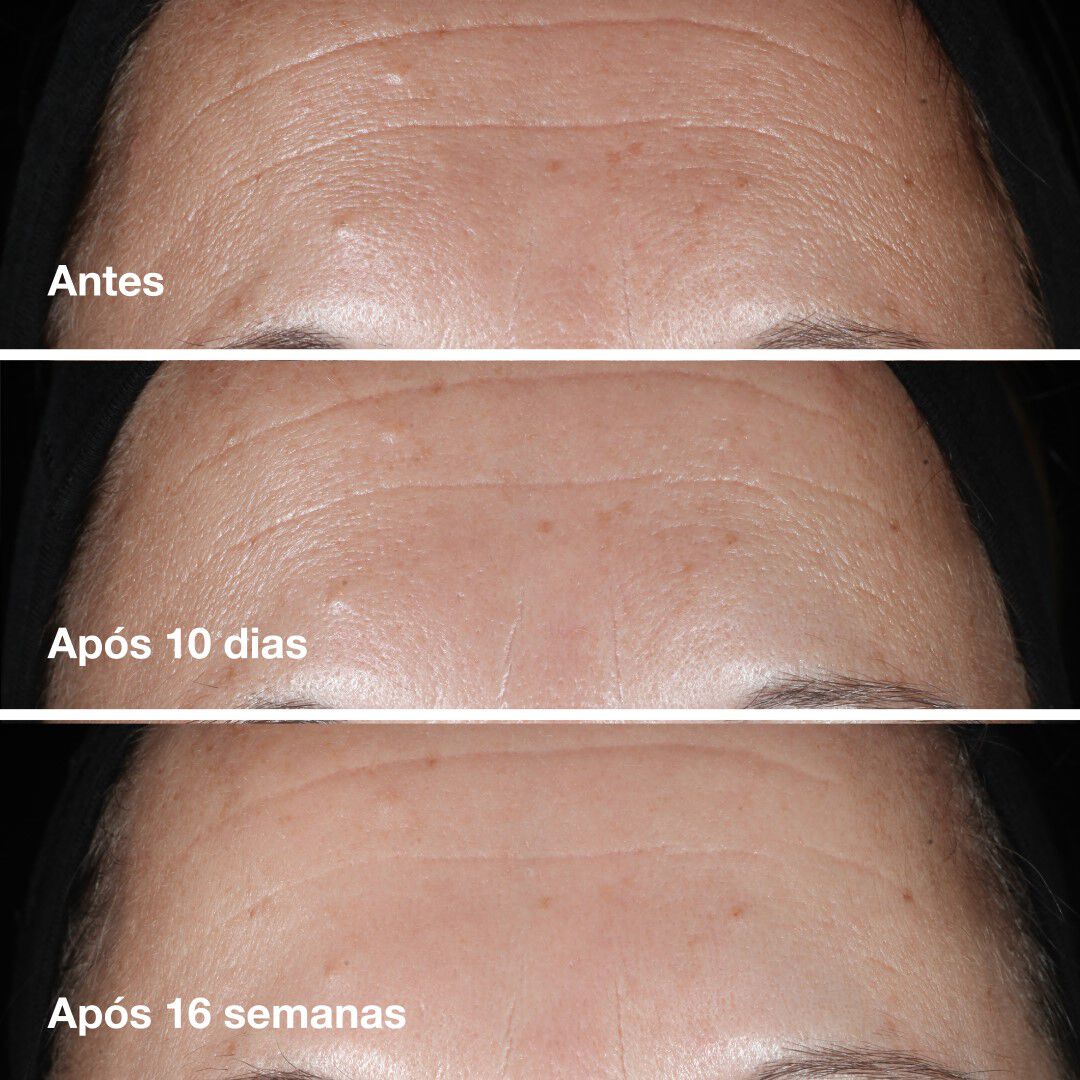 Clinique Smart Clinical Repair™ Wrinkle Correcting Serum - CLINIQUE - Smart - Imagem 4