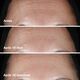 Clinique Smart Clinical Repair™ Wrinkle Correcting Serum - CLINIQUE - Smart - Imagem 4
