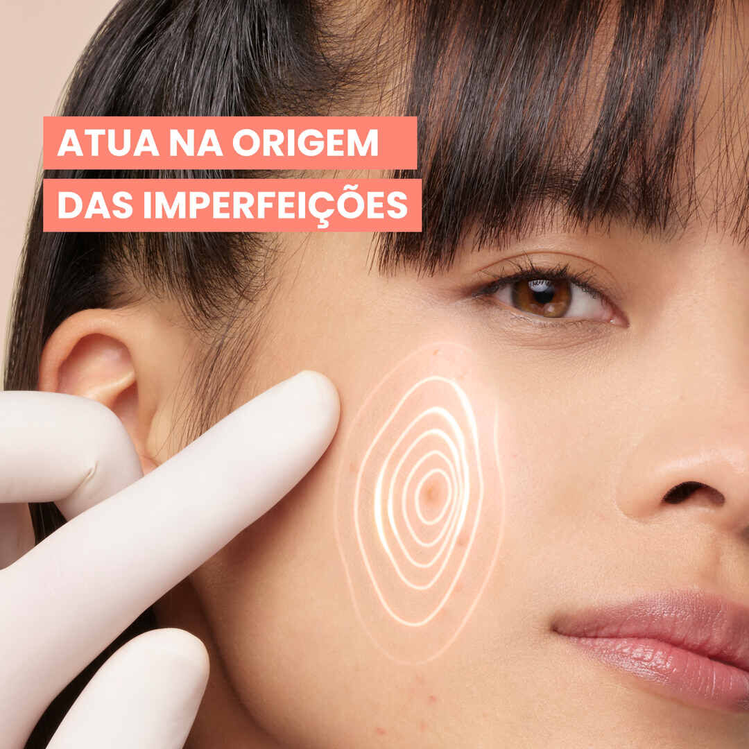 Cleanance Comedomed+ Concentrado Anti-imperfeições - AVENE -  - Imagem 4