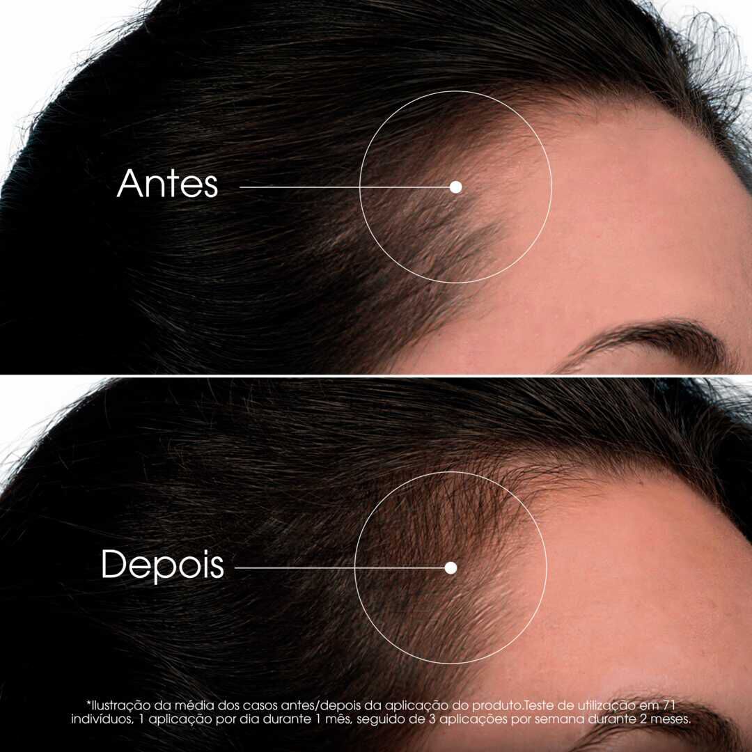 S&eacute;rum Quinina Acelerador Crescimento - KLORANE -  - Imagem 2