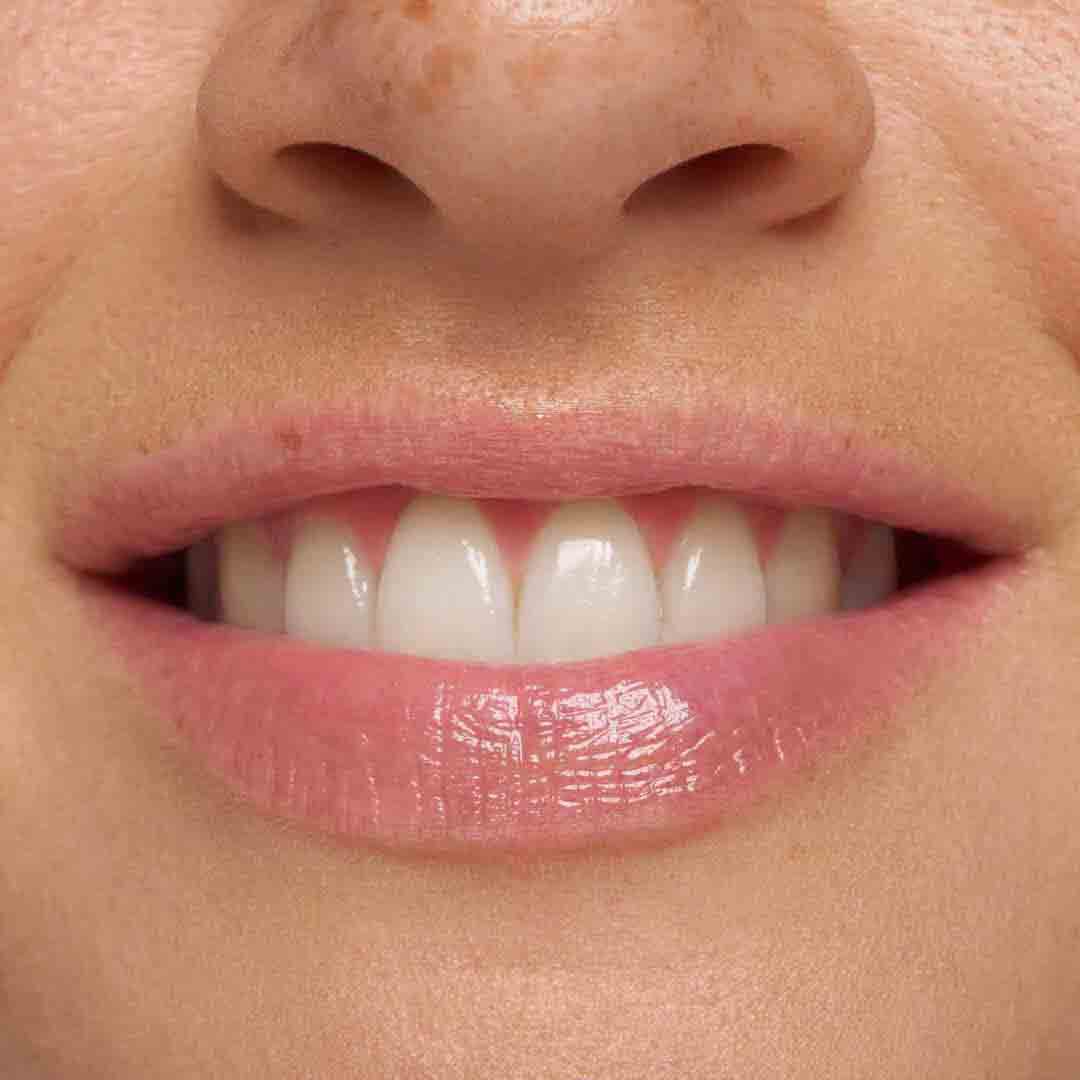 M&aacute;scara de Cuidado Swirl - ESSENCE -  - Imagem 10