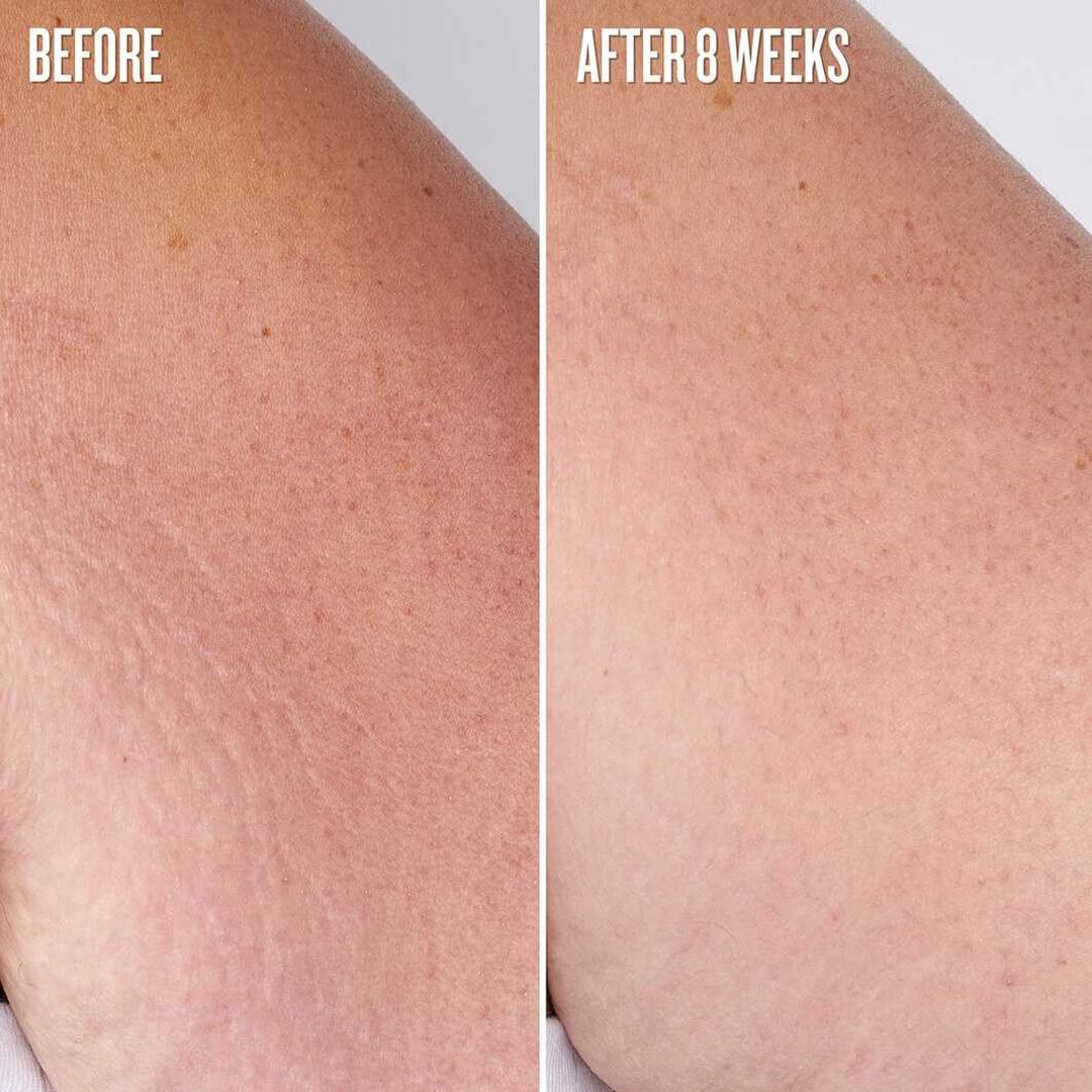 Elasti-Body Oil - &Oacute;leo Para o corpo - Sol de Janeiro - Beja Flor - Imagem 4