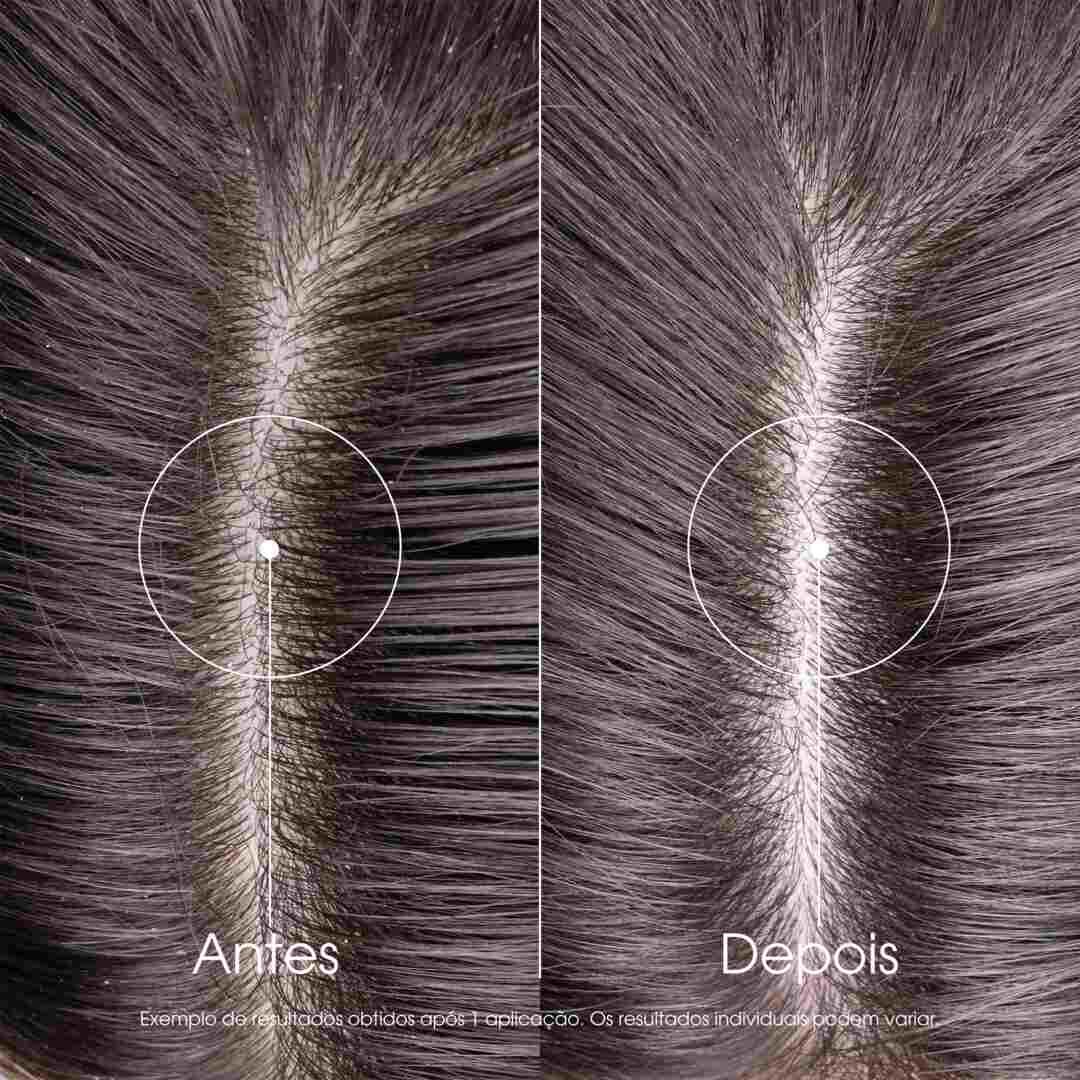 Champ&ocirc; Cidra - KLORANE -  - Imagem 7