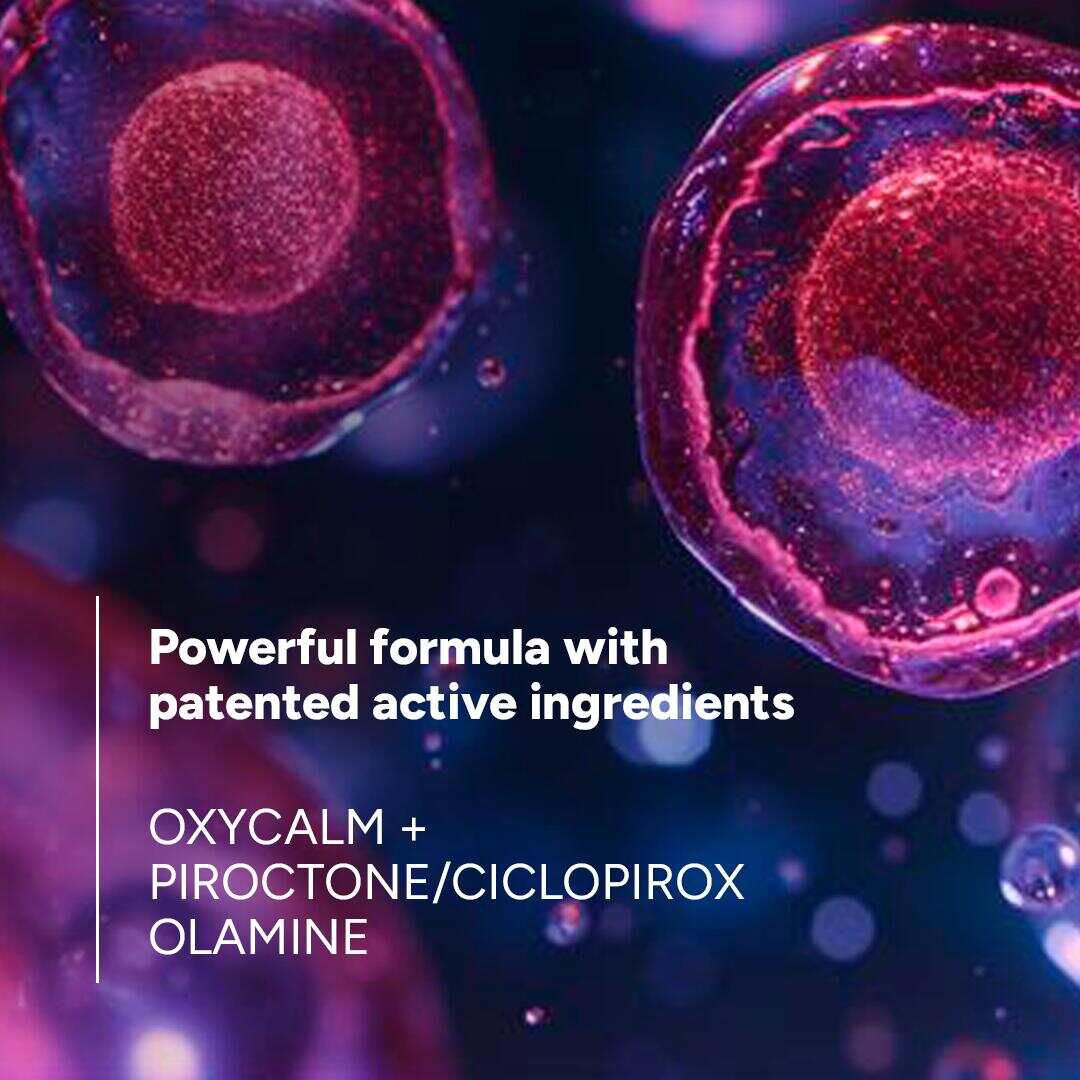 Kelual DS Intensive Champ&ocirc; Caspa Severa - DUCRAY -  - Imagem 5